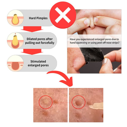 Blackhead Suction Water (blackhead remover cleanser)