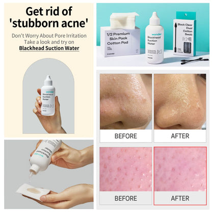 Blackhead Suction Water (blackhead remover cleanser)