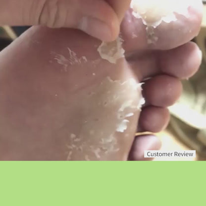 Good-bye Dirty Foot Solution | Foot Exfoliation